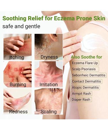 Eczema Cream Psoriasis Dermatitis & Rashes Treatment Moisturizer for Dry Itchy & Sensitive Skin Face Scalp & Body Soothing Eczema Itch Relief 3.53 OZ 3.53 Ounce - Buy Online on GoSupps.com