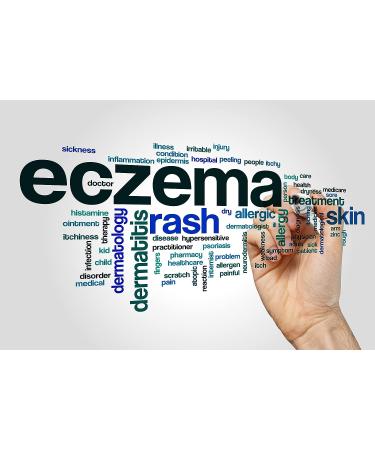 Raw African Black Soap 5 lb Bar - Acne Treatment & Dark Spot Remover for All Skin Types - Face, Body, Hair - From Ghana, West Africa - Anti-Aging - Ideal for Ethnic & Oily White Skin - Use with Shea Butter - Buy Online on GoSupps.com