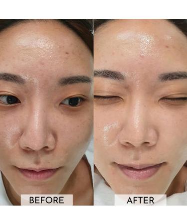 Cell EGF FGF Repairing Ampoule: Korean Skincare Serum for Skin Renewal & Protection - 1Fl.Oz - Buy Online on GoSupps.com
