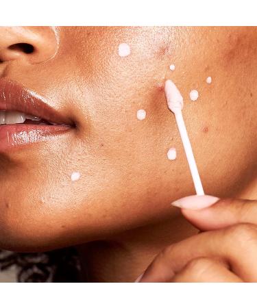 Kate Somerville EradiKate Acne Treatment - 10% Sulfur & BHA Spot Treatment for Clear Skin, 1 Fl Oz - Buy Online on GoSupps.com