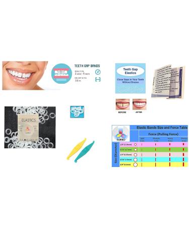 IVORIE Teeth Gap Bands 80 Pack - Clear Dental Elastic Bands for Orthodontic Use - Buy Online on GoSupps.com