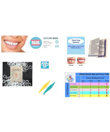 IVORIE Clear Dental Teeth Gap Bands 80/Pack (3/16 Heavy) - Orthodontic Elastic Bands - Buy Online on GoSupps.com