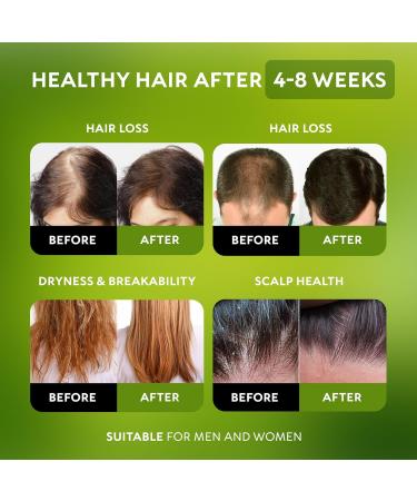 100% Pure Batana Oil for Hair Growth | Organic & Chemical-Free | Enhance Your Hair Naturally - Buy Online on GoSupps.com