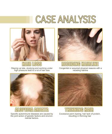 Natural Hair Growth Oil - Repair Thin Dry Damaged Hair | Unscented Black Castor Oil 2 Fl Oz - International Shipping Available - Buy Online on GoSupps.com