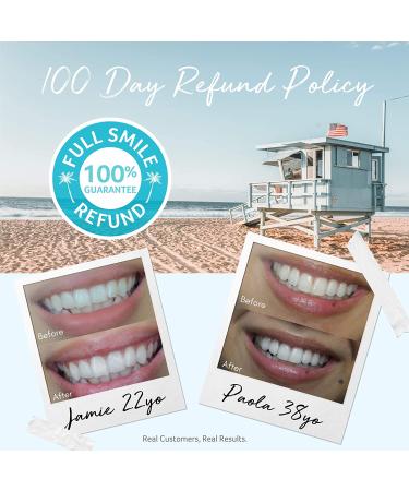 Cali White 35% Carbamide Peroxide Teeth Whitening Gel Refills - Natural Vegan Organic Whitener - 3X 5mL Syringes - Made in USA - for Sensitive Teeth - Use with UV or LED Light & Trays - Buy Online on GoSupps.com