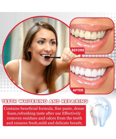 Hpbaggy 1 piece Sp6 Toothpaste Sp6 Probiotic Toothpaste Toothpaste Whitening 120g Sp 6 Toothpaste Probiotics Bright White Toothpaste Teeth Whitening Deep Cleaning Toothpaste - Buy Online on GoSupps.com