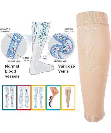 Calf Compression Stockings for Women & Men | Varicose Veins Relief | Elastic Leg Covers | Reduce Swelling & Discomfort - Buy Online on GoSupps.com