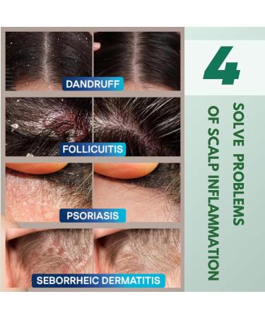 ABERA Alan Silver Serum Botanical Hydrating Serum for Dry & Sensitive Skin & Herbal Extracts Daily Moisturizer for Face Body & Scalp Fast Absorbing Lightweight 3 boxes - Buy Online on GoSupps.com