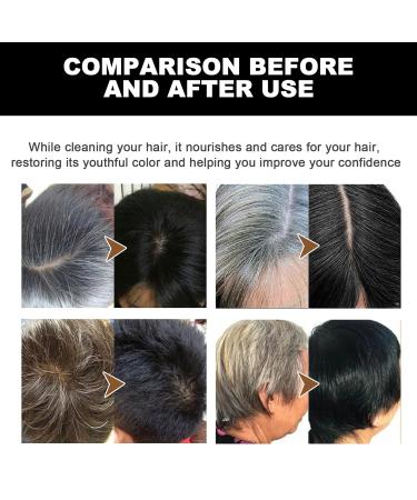 Youthful Hair Rejuvenation Soap Bar - Natural Gray Hair Reversal for Men & Women | 5PCS - Shop Internationally - Buy Online on GoSupps.com