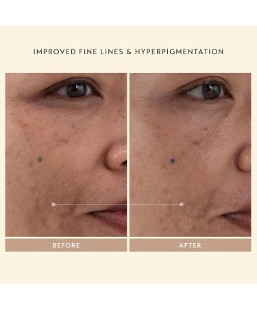 SHANI DARDEN SKINCARE Retinol Reform Duo - Anti-Aging Resurfacing Serum for Face & Neck | Full & Travel Size | Fine Lines & Wrinkles Treatment - Buy Online on GoSupps.com