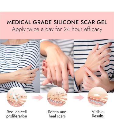 Scarbandit Silicone Scar Gel - Medical Grade Treatment for Surgical and Acne Scars - Moisturizes, Reduces Redness - Clear, Odorless - 0.35oz - Kids & Adults - Buy Online on GoSupps.com