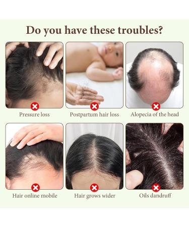 Ginger Anti-hair loss shampoo Anti-hair loss shampoo 3 boxes Hair regrowth shampoo Used to improve dry and frizzy hair (1 massage comb) - Buy Online on GoSupps.com
