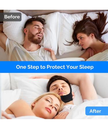 Adjustable Chin Strap for Snoring - Effective Anti-Snoring Solution - Buy Online on GoSupps.com