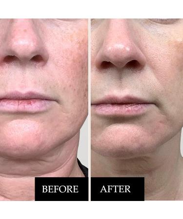 Facial Care Pack: Retinol Cream and Vitamin C Serum - Anti-Aging Anti-Wrinkle Moisturizing - Reduces Dark Spots Brightens and Firms Skin - Professional Facial Care - Buy Online on GoSupps.com