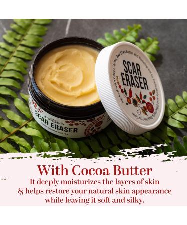 Better Shea Butter Scar Eraser Balm | Cocoa Butter Cream for Stretch Marks Dark Spots & Scars - Natural Ingredients 4 oz - Buy Online on GoSupps.com