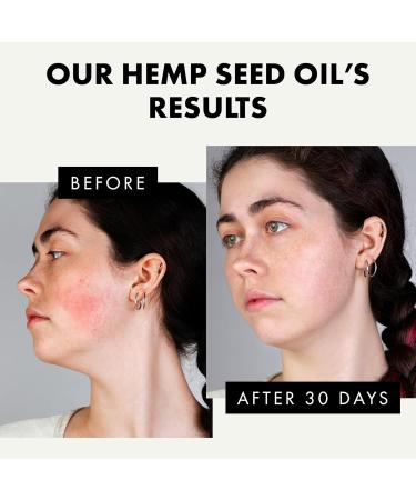 Hemp Seed Oil for Face & Skin 100% Made from Hemp Seed - Hemp Oil to Moisturize Hydrates & Boosts Elasticity of Skin - Pure & Unrefined Hemp Oil 30 ml - Buy Online on GoSupps.com