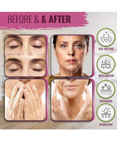 Medix 5.5 Retinol Cream & Hyaluronic Acid Lotion Set | Anti-Aging Moisturizer for Wrinkles & Dry Skin - 15 Fl Oz - Pack of 2 - Buy Online on GoSupps.com