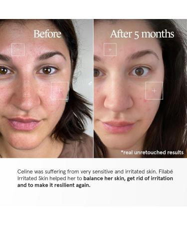Filab of Switzerland AG Irritated Skin For the treatment of sensitive skin with redness and dry irritated areas 28 days Vegan and additivefree Swiss made by Filab of Switzerland - Buy Online on GoSupps.com