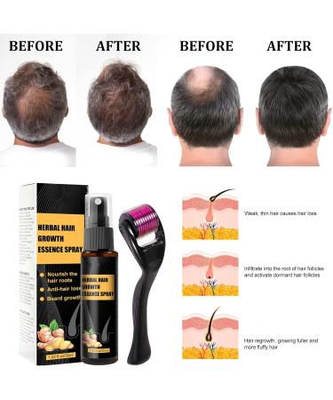 Ginger Sprout Oil Ginger Hair Growth Essence Moisturizing Treatment for Women and Men Hair Growth Oil 30ml (5pcs) - Buy Online on GoSupps.com