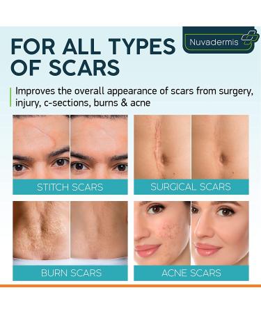 Scar Cream Gel with Retinol, Allantoin, Vitamin E, Betaine - Post Surgery Treatment for C-Section, Tummy Tuck, Keloid, Acne Removal - 1.7 oz - Buy Online on GoSupps.com