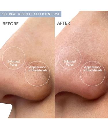 PMD Wave Pro - Professional-Grade Advanced Skin Spatula - Extract Infuse & Lift - SonicGlow Vibration Technology and EMS - Clear Pores Blackheads & Whiteheads - Buy Online on GoSupps.com