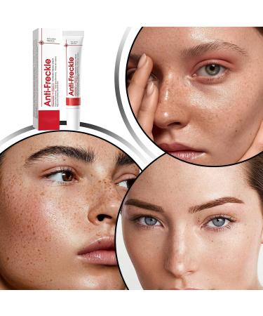 Freckle Remover For The Face Correcting Skin Imperfections Relieving & Repairing Face Cream for Skin Care Body and Women - Buy Online on GoSupps.com