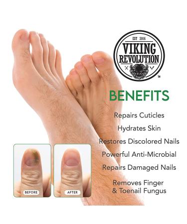 Extra Strength Toenail Fungus Treatment - Antifungal Nail Solution for Athletes Foot & Fungal Nail Infections - Buy Online on GoSupps.com