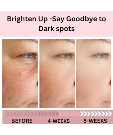 EIRENE BEAUTY Dark Spot Remover for Face and Body Dark Spot Corrector Serum - Advanced Treatment Sun Spot Age Spot Brown Spot Reduce for Women - 30mL - Buy Online on GoSupps.com