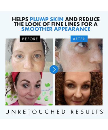 Eclat Skincare Hyaluronic Acid + Niacinamide Face Serum Bundle Hydrating & Clarifying Skincare Duo with Vitamin B5 Zinc PCA & Botanical Extracts Plumper-Looking Skin Refined Texture & Radiant Ap - Buy Online on GoSupps.com