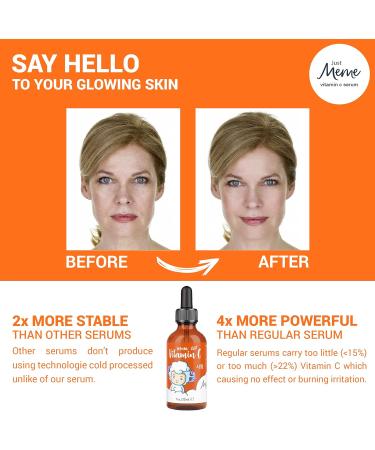 MeMe Vitamin C Serum for Face | Korean Skin Care with Hyaluronic Acid, Retinol & Vitamin E | Anti Wrinkle Eye Serum | Dark Circles Remover - Dermaroller Suitable - Buy Online on GoSupps.com