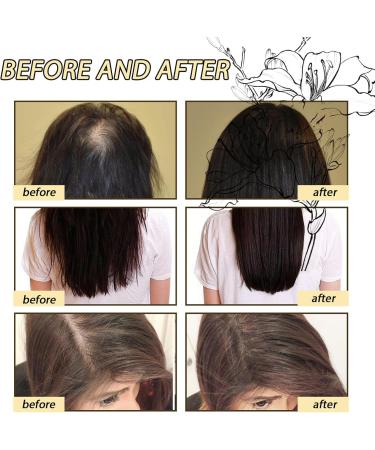 LINXINS Veganic Natural Hair Growth Oil (120ml) Natural Hair Growth Oil Organic for Thin Hair Hair Oil for Dry Damaged Hair and Growth Veganic Hair Oil for Hair Growth - Buy Online on GoSupps.com