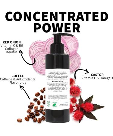 Made in France Shampoo against hair loss with onion and caffeine Fast hair growth Antigrease Antidandruff Moisturizer Sulfatefree parabenfree multi 500 ml - Buy Online on GoSupps.com
