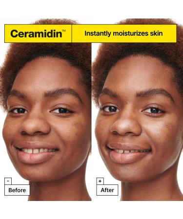 Dr.Jart+ Ceramidin Moisture Treats Korean Skin Care Ornament Gift Set Travel Size Ceramide Face Moisturizer and Full Size Lip Balm for Hydration and Skin Barrier Repair Limited Edition Holiday Set - Buy Online on GoSupps.com