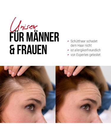 Hair Effect - Full Hair in Seconds! Premium 26g Stray Hair for Instant Volume | Authentic Medium Brown Solution for Men & Women - Buy Online on GoSupps.com