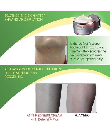 Redness Relief Face Eczema Cream - All-Natural Anti-Itch Treatment for Rosacea & Eczema - Hormone-Free Moisturizer for Facial & Body Care - Buy Online on GoSupps.com