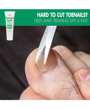 Toenail Softening Cream for Thick Hard Nails | Aloe Infused 1 Oz | Temporary Nail Care Solution - Shop Internationally - Buy Online on GoSupps.com