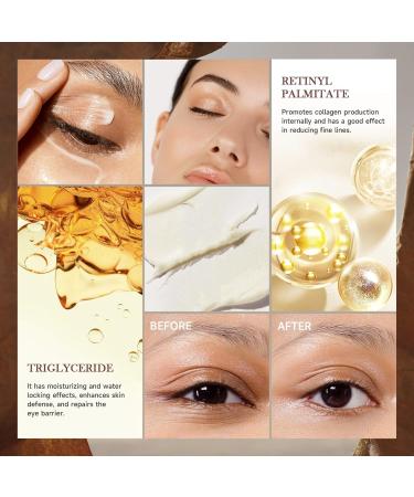 Retinol Eye Balm Stick Anti-Aging Under Eye Cream for Dark Circles Puffiness & Fine Lines Eye Bags Eye Stick with Collagen Moisturizes Nourishes Hydrates Smooths Skin Suitable for Women & Men - Buy Online on GoSupps.com