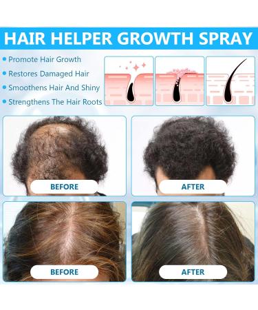 Bello Rice Water Hair Thickening Spray for Thinning and Damaged Hair Growth (2pcs) - Buy Online on GoSupps.com
