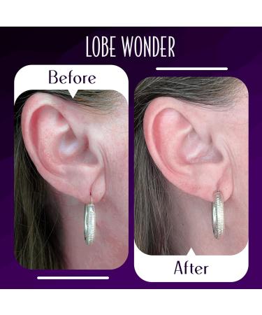 Lobe Wonder - The Original Ear Lobe Support Patch for Pierced Ears - Eliminates The Look of Torn or Stretched Piercings - Protects Healthy Ear Lobes from Tearing - 180 Patches - Buy Online on GoSupps.com