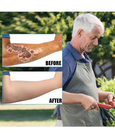 2 Pairs Elderly Arm Protectors for Thin & Bruising Compression - Nude Color, Elegant Style | Washable, Men & Women | Medium - Buy Online on GoSupps.com