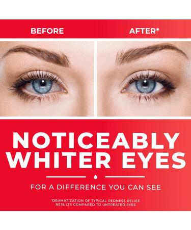 Clear Eyes Redness Relief Eye Drops - 1.0 Fl Oz & 2 Pocket Pals - Fast International Shipping - Buy Online on GoSupps.com