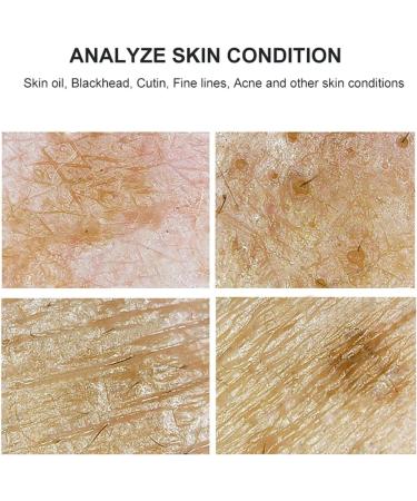 Professional 7 Inch Hair Follicle Oil Moisture Tester Scalp Detector Skin Analyzer Machine Facial Skin Hair Analyzer Machine - Buy Online on GoSupps.com