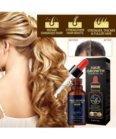 5% Biotin Minoxidil Hair Growth Oil 5% Minoxidil for Men and Women Hair Growth Serum Minoxidil Biotin Hair Growth Serum Nourishes Scalp Stops Hair Loss & Thinning 20ml (60ml) - Buy Online on GoSupps.com