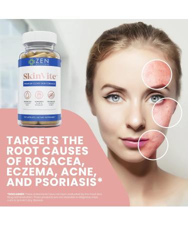 Zen Nutrients SkinVite Acne Eczema Psoriasis Rosacea Treatment - Clear Skin Probiotics & Hormonal Acne Supplement for Men, Women, Teens - 60 Count - Buy Online on GoSupps.com