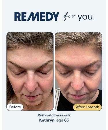 Remedy The Must Haves Duo | 2-Piece Essential System | Healthy Aging Treatment & Lip Balm | Retinol, Ceramides, Peptides, Niacinamide | Created by Dermatologist Dr. Shah | Vegan & Cruelty-Free - Buy Online on GoSupps.com