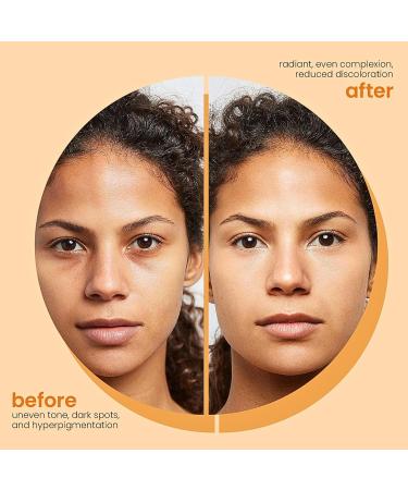 Kojic Acid & Turmeric Face Wash Foaming Cleanser Turmeric Facial Cleanser Gentle Foaming Face Wash for Oily Skin Acne Prone Skin Turmeric Mousse Cleanser for Dark Spots Removes Excess Oil - Buy Online on GoSupps.com