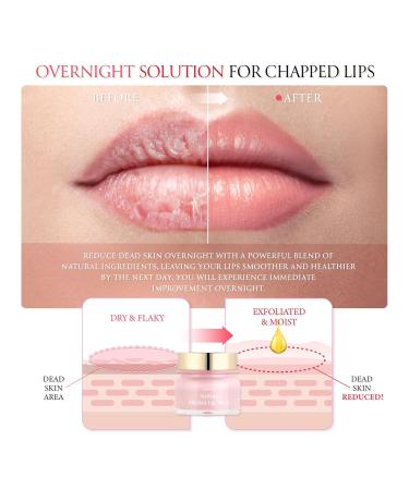 FORENCOS Melting Sherbet Lip Mask Overnight Treatment with Manuka Honey Olive Oil & Vitamin E Sleeping Mask & Repair Moisturizer for Dry Cracked Lips Nourishing Care 0.7 oz - Buy Online on GoSupps.com