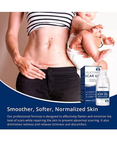  Facynde Face Scar - Scar Cream Anti Scar Gel Cream Scar Reduction Advanced Postoperative Supplies Facial Scar Management Facyn - Buy Online on GoSupps.com