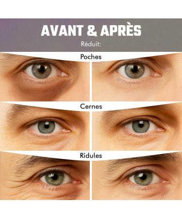 Patch yeux au Bakuchiol (20 paires) Masque yeux avec Caf ine Niacinamide et Acide Hyaluronique Patch anti cernes pour cernes poches et rides R duit les Signes de Fatigue - Buy Online on GoSupps.com