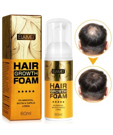 5% Minoxidil Foam for Men & Women Hair Regrowth Treatment  Keeps Hair Regrowth  Stop Hair Loss and Thinning  Helps Hair Growth  Promotes Hair Follicle Growth  Mild Non-irritating Formula  2.11fl oz